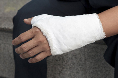 Personal injury